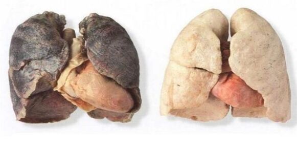 pulmóns de fumadores e non fumadores
