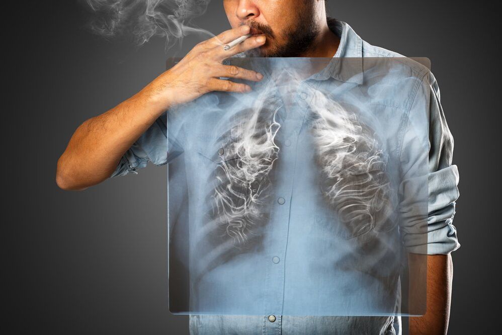 fumar ten un efecto prexudicial sobre o corpo humano
